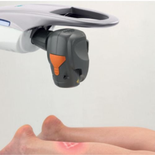 Robotic MLS High Power Laser